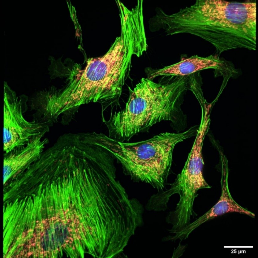 染色的BPAE細胞.jpg 染色的BPAE細胞.jpg