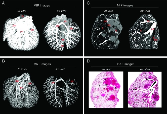 肺部研究-1.jpg 肺部研究-1.jpg